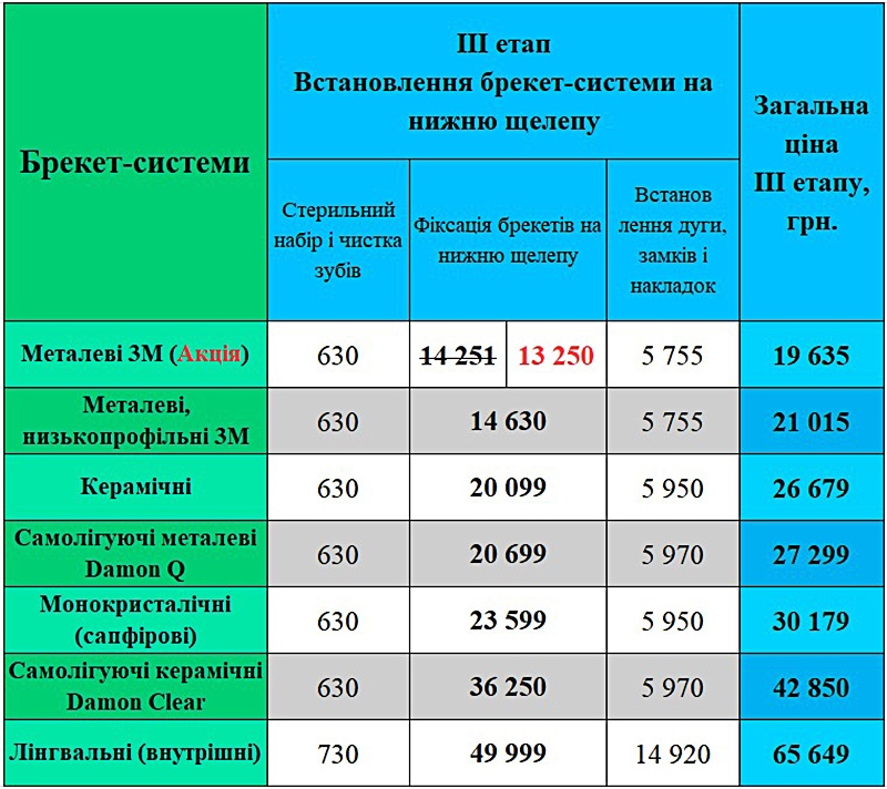 Встановлення брекет-системи ціна Київ ЛюміДент